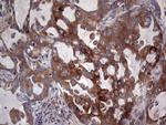 PKM2 Antibody in Immunohistochemistry (Paraffin) (IHC (P))