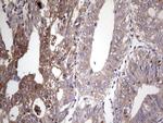 PKM2 Antibody in Immunohistochemistry (Paraffin) (IHC (P))