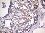 PKM2 Antibody in Immunohistochemistry (Paraffin) (IHC (P))