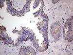 PKM2 Antibody in Immunohistochemistry (Paraffin) (IHC (P))