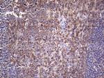 PKM2 Antibody in Immunohistochemistry (Paraffin) (IHC (P))