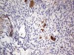 PKM2 Antibody in Immunohistochemistry (Paraffin) (IHC (P))