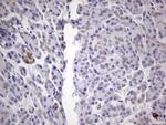 PKM2 Antibody in Immunohistochemistry (Paraffin) (IHC (P))