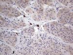 PKM2 Antibody in Immunohistochemistry (Paraffin) (IHC (P))