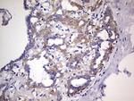 PKM2 Antibody in Immunohistochemistry (Paraffin) (IHC (P))