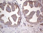 PKM2 Antibody in Immunohistochemistry (Paraffin) (IHC (P))