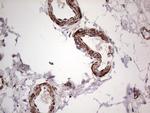 PKM2 Antibody in Immunohistochemistry (Paraffin) (IHC (P))