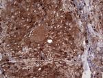 PKM2 Antibody in Immunohistochemistry (Paraffin) (IHC (P))