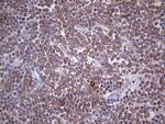 PKM2 Antibody in Immunohistochemistry (Paraffin) (IHC (P))