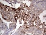 PKM2 Antibody in Immunohistochemistry (Paraffin) (IHC (P))