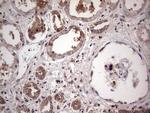 PKM2 Antibody in Immunohistochemistry (Paraffin) (IHC (P))