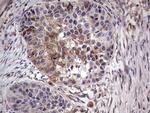 PKM2 Antibody in Immunohistochemistry (Paraffin) (IHC (P))