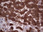 PKM2 Antibody in Immunohistochemistry (Paraffin) (IHC (P))