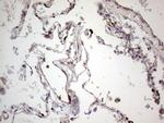 PKM2 Antibody in Immunohistochemistry (Paraffin) (IHC (P))