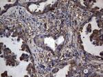 PKM2 Antibody in Immunohistochemistry (Paraffin) (IHC (P))