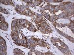 PKM2 Antibody in Immunohistochemistry (Paraffin) (IHC (P))