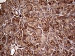 PKM2 Antibody in Immunohistochemistry (Paraffin) (IHC (P))