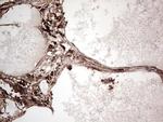 PKM2 Antibody in Immunohistochemistry (Paraffin) (IHC (P))