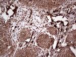 PKM2 Antibody in Immunohistochemistry (Paraffin) (IHC (P))