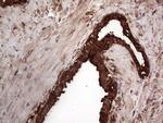 PKM2 Antibody in Immunohistochemistry (Paraffin) (IHC (P))