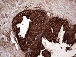 PKM2 Antibody in Immunohistochemistry (Paraffin) (IHC (P))