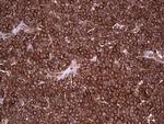 PKM2 Antibody in Immunohistochemistry (Paraffin) (IHC (P))