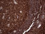 PKM2 Antibody in Immunohistochemistry (Paraffin) (IHC (P))