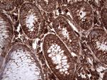 PKM2 Antibody in Immunohistochemistry (Paraffin) (IHC (P))