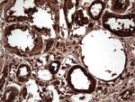 PKM2 Antibody in Immunohistochemistry (Paraffin) (IHC (P))