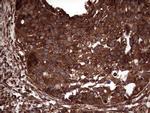 PKM2 Antibody in Immunohistochemistry (Paraffin) (IHC (P))