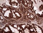 PKM2 Antibody in Immunohistochemistry (Paraffin) (IHC (P))