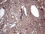 PKM2 Antibody in Immunohistochemistry (Paraffin) (IHC (P))