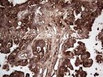 PKM2 Antibody in Immunohistochemistry (Paraffin) (IHC (P))