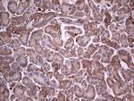 PKM2 Antibody in Immunohistochemistry (Paraffin) (IHC (P))