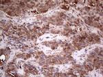 PKM2 Antibody in Immunohistochemistry (Paraffin) (IHC (P))