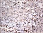 PKM2 Antibody in Immunohistochemistry (Paraffin) (IHC (P))