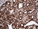 PKM2 Antibody in Immunohistochemistry (Paraffin) (IHC (P))