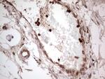 PKM2 Antibody in Immunohistochemistry (Paraffin) (IHC (P))