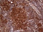 PKM2 Antibody in Immunohistochemistry (Paraffin) (IHC (P))