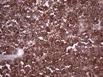 PKM2 Antibody in Immunohistochemistry (Paraffin) (IHC (P))