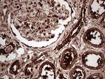 PKM2 Antibody in Immunohistochemistry (Paraffin) (IHC (P))