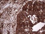 PKM2 Antibody in Immunohistochemistry (Paraffin) (IHC (P))