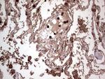 PKM2 Antibody in Immunohistochemistry (Paraffin) (IHC (P))