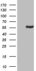 PKM2 Antibody in Western Blot (WB)