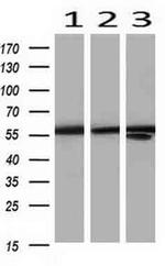 PKM2 Antibody in Western Blot (WB)