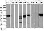 PKM2 Antibody in Western Blot (WB)