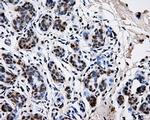 PKMYT1 Antibody in Immunohistochemistry (Paraffin) (IHC (P))