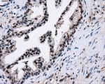 PKMYT1 Antibody in Immunohistochemistry (Paraffin) (IHC (P))