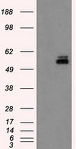 PKMYT1 Antibody in Western Blot (WB)