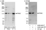 PKN2 Antibody in Western Blot (WB)